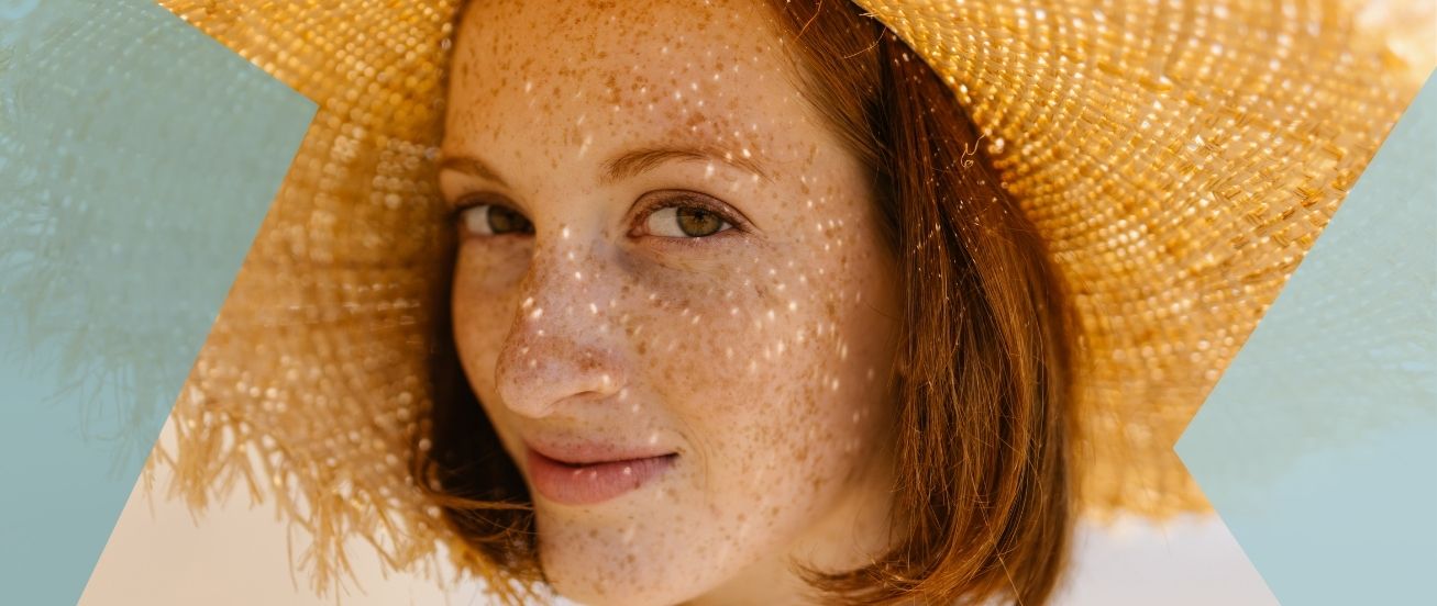 Tratamientos de manchas solares