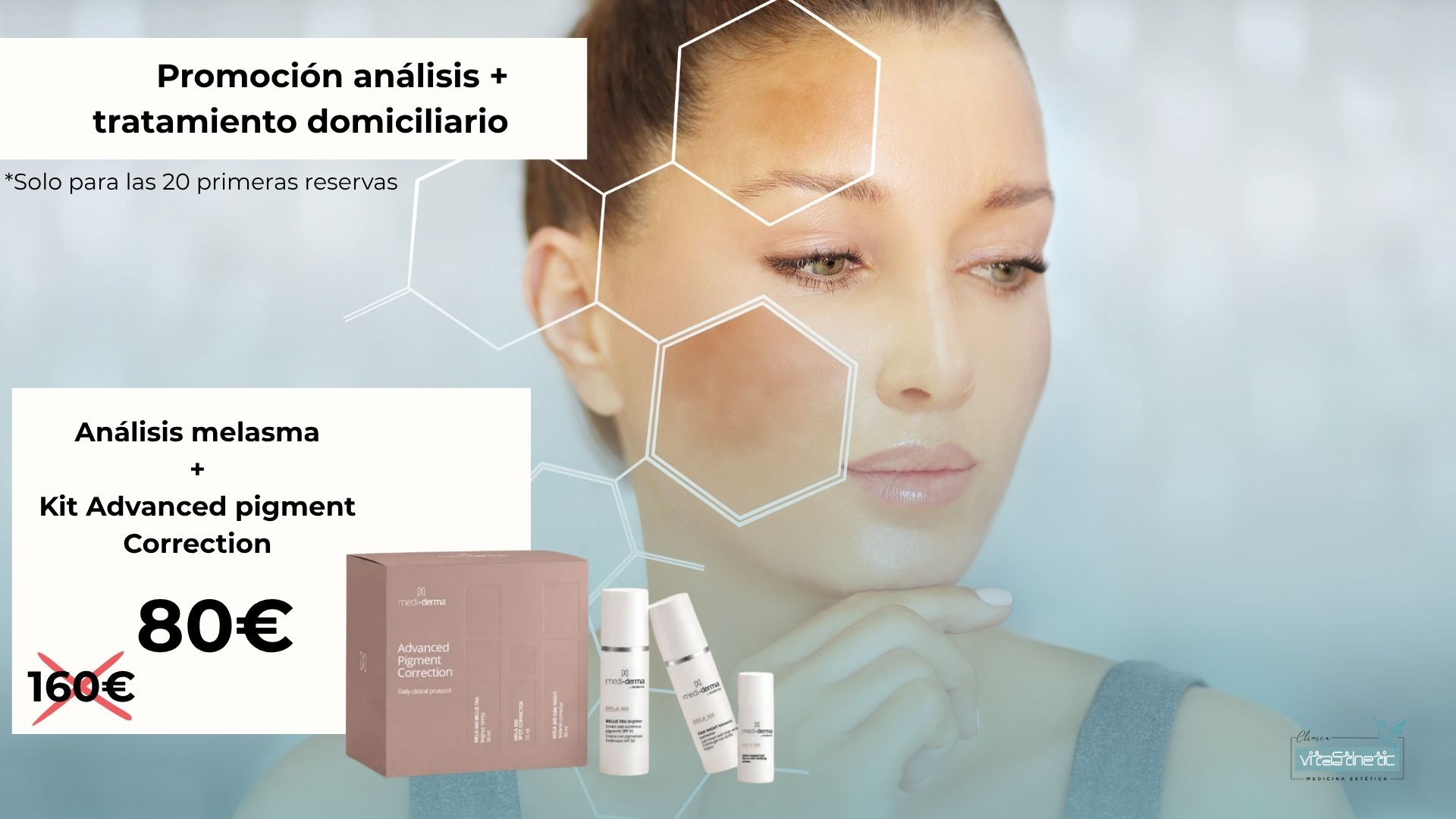 MELASMA GRANADA